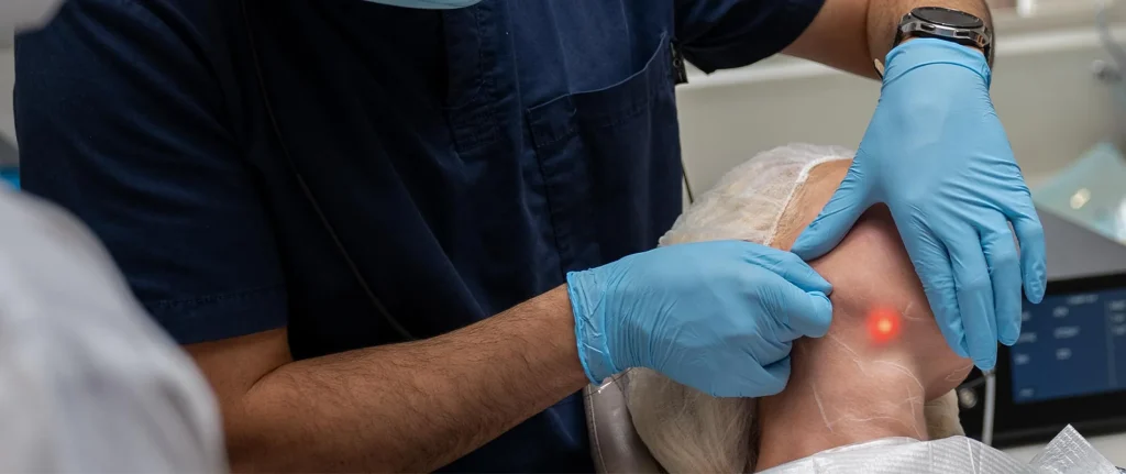 How Does the Endolift Machine Work?