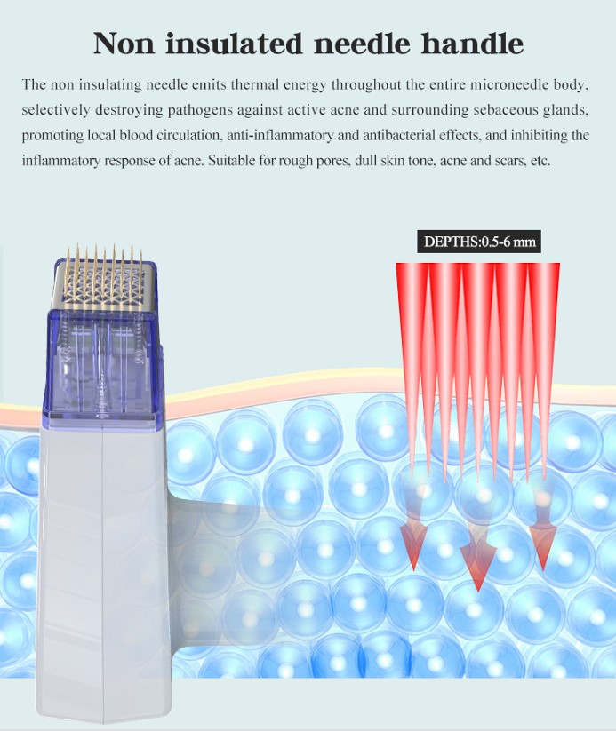 Microneedle Characteristics