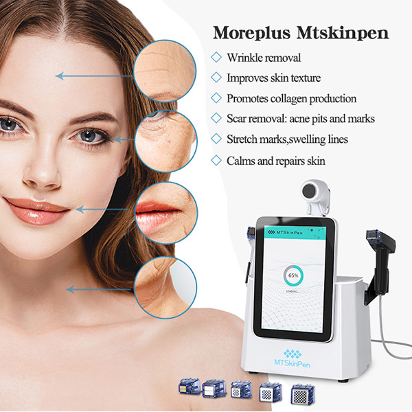 RF Microneedling Facial Machine Advantages And Highlights