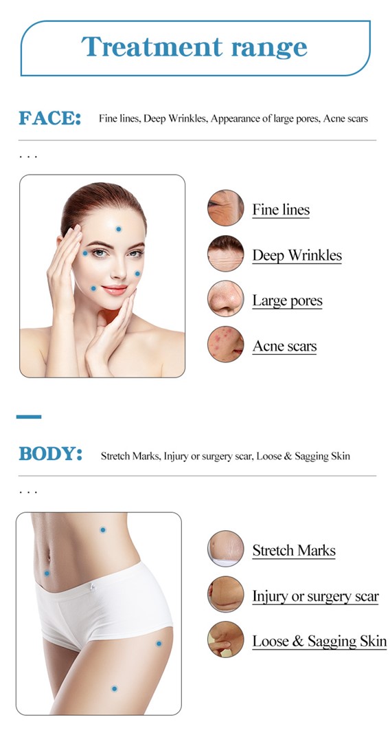 Applications of the Morpheus8 RF Microneedling Machine
