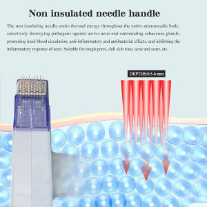 What Is RF Microneedling? Your Complete Guide to Benefits, Costs & Results