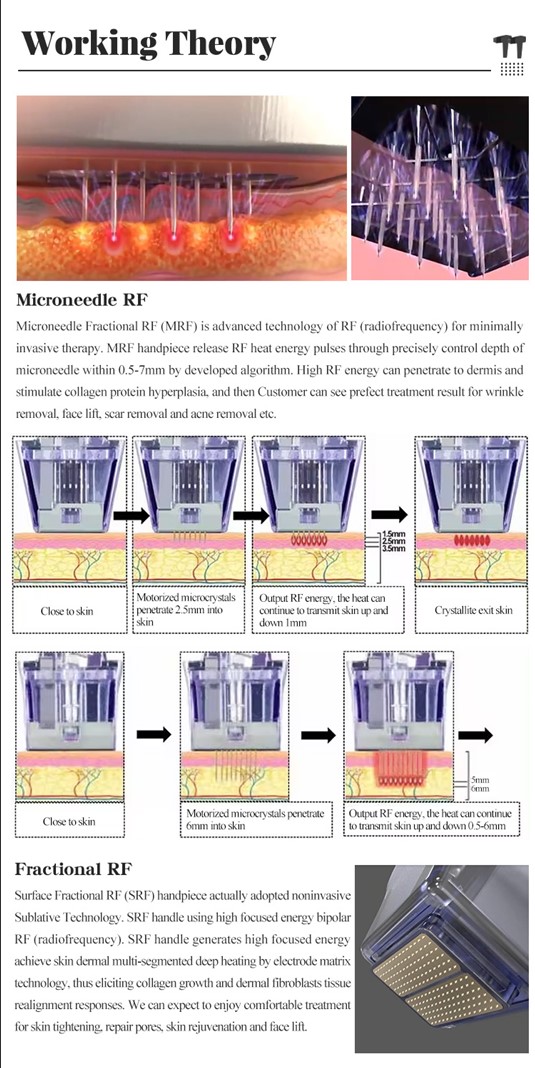 How RF Microneedling Machine Works