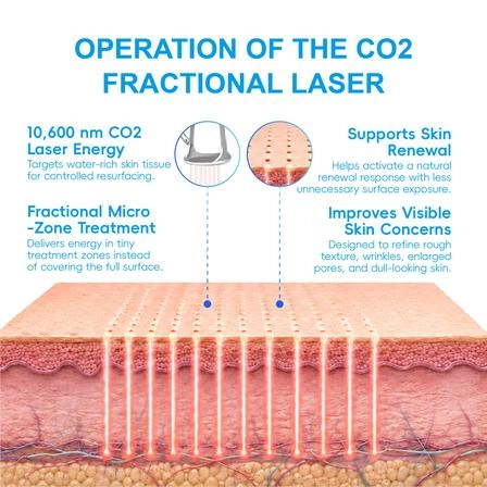 What Is a Fractional CO2 Laser Machine?