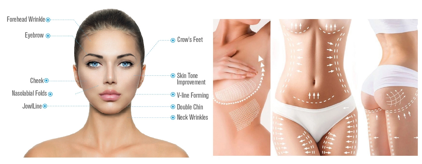 Non‑Surgical Face‑Lifting: HIFU Machine For Beauty Salons Non‑Surgical Face‑Lifting: HIFU Machine For Beauty Salons