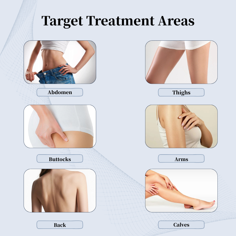 Treatment Areas