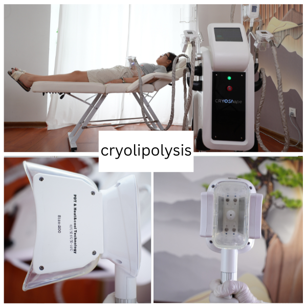 Clinical Treatment Process and Close-up of 360 Surround Cooling Handle Cup
