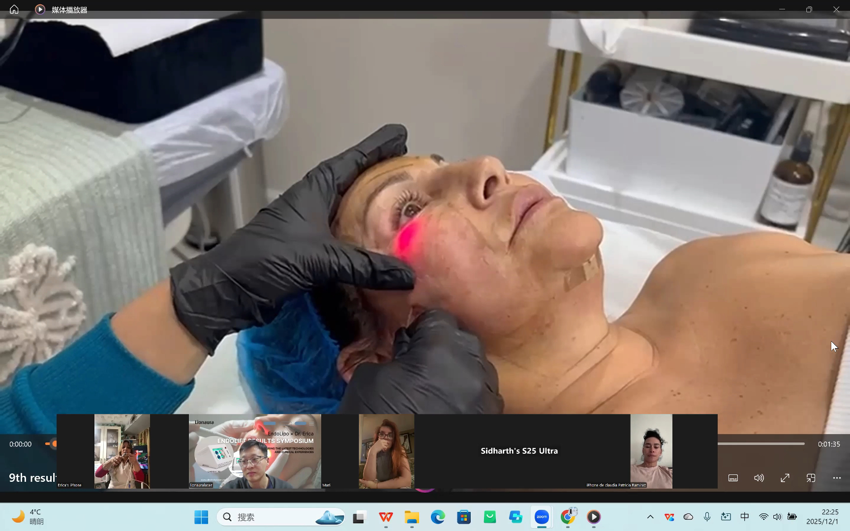 Endolift Facial Treatment