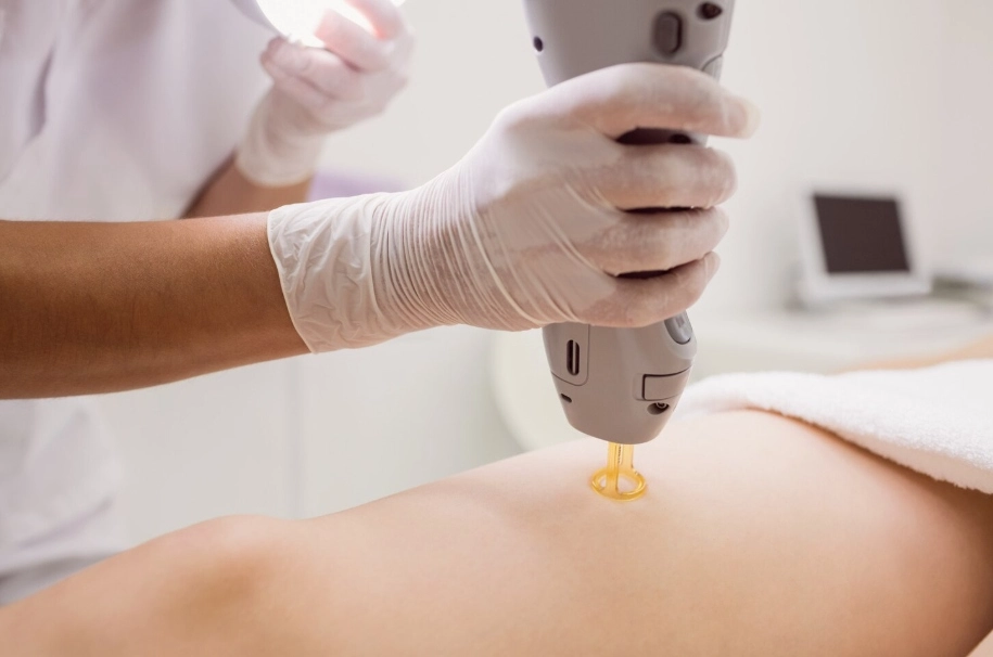Diode laser therapy
