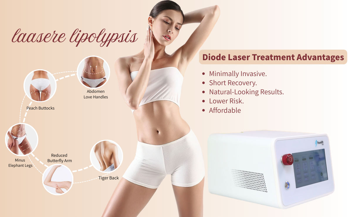 Endolift Laser Treatment Advantages
