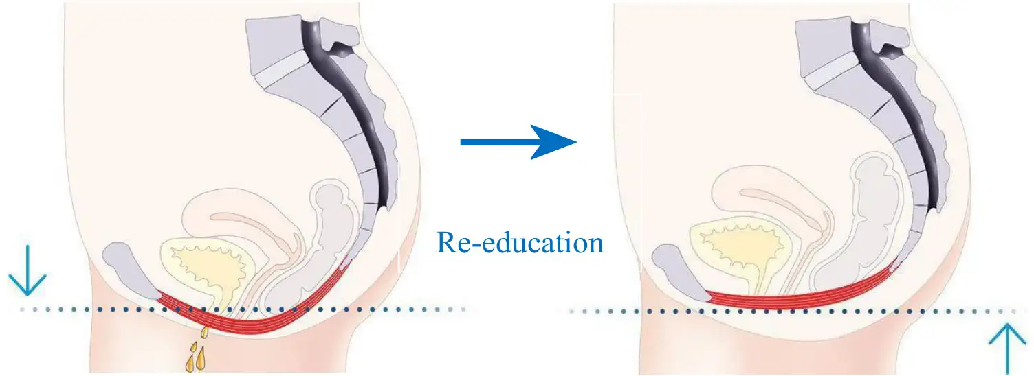 Benefits of the Pelvic Floor Muscle Chair