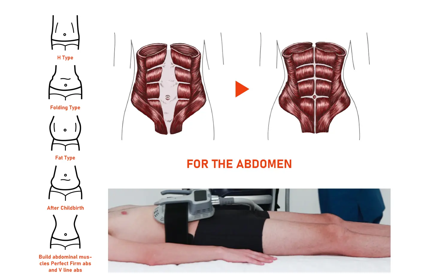 What Are the Key Benefits of an EMS Body Sculpting Machine?