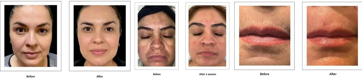Before & After Clinical Results