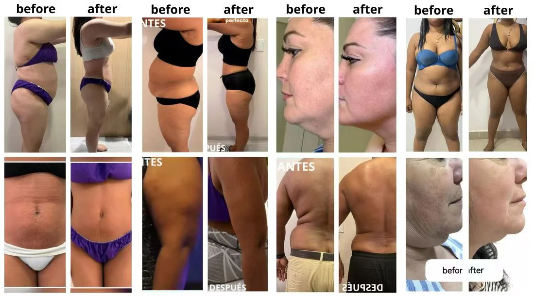 Before and After