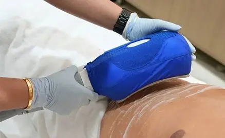 Abdomen Contouring