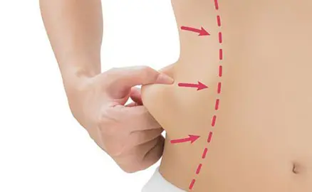 Waist & Flank Contouring